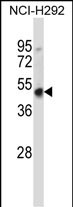 WB - Mouse Hoxd3 Antibody (C-term) AP14466b