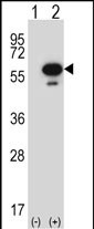 WB - Mouse Stk25 Antibody (C-term) AP14468b