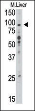 Western blot analysis of anti-TLR6 Pab (Cat. #AP1506a) in mouse liver tissue lysate (35ug/lane). TLR6(arrow) was detected using the purified Pab.