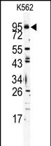 Western blot analysis of Mouse TLR6 Antibody (C-term) (Cat.# AP1506c) in  K562 cell line lysates (35ug/lane). TLR6 (arrow) was detected using the purified Pab.