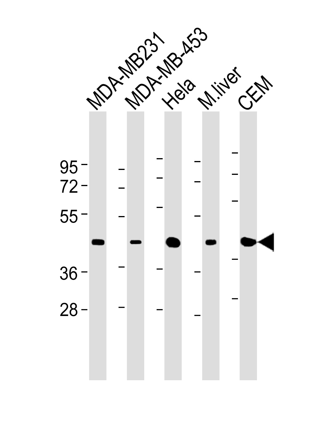 All lanes : Anti-ACTA1 Antibody at 1:500-1:1000 dilutionLane 1: MDA-MB231 whole cell lysateLane 2: MDA-MB-453 whole cell lysateLane 3: Hela whole cell lysateLane 4: mouse liver lysateLane 5: CEM whole cell lysateSecondaryGoat Anti-mouse IgG, (H+L),Peroxidase conjugated at 1/10000 dilution.Predicted band size : 42051 DaBlocking/Dilution buffer: 5% NFDM/TBST.