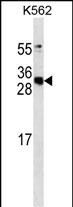 APCS antibody (Cat. #AM1978a) western blot analysis in K562 cell line lysates (35?g/lane).This demonstrates the APCS antibody detected the APCS protein (arrow).