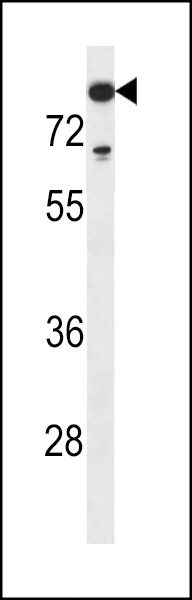 TdT Antibody (N-term) (Cat. #AP14478a) western blot analysis in MDA-MB453 cell line lysates (35ug/lane).This demonstrates the TdT antibody detected the TdT protein (arrow).