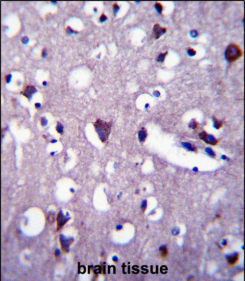 IHC-P - CNGA2 Antibody (N-term) AP14486a