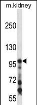 COL1A1 Antibody (C-term) (Cat. #AP14490b) western blot analysis in mouse kidney tissue lysates (35ug/lane).This demonstrates the COL1A1 antibody detected the COL1A1 protein (arrow).