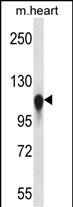 WB - KIF5C Antibody (C-term) AP14507b