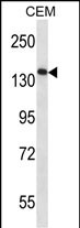 AATK Antibody (N-term) (Cat. #AP14516a) western blot analysis in CEM cell line lysates (35ug/lane).This demonstrates the AATK antibody detected the AATK protein (arrow).