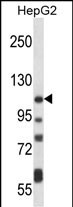 WB - ATP2B4 Antibody (C-term) AP14531B
