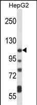 ATP2B4 Antibody (C-term) (Cat. #AP14531b) western blot analysis in HepG2 cell line lysates (35ug/lane).This demonstrates the ATP2B4 antibody detected the ATP2B4 protein (arrow).