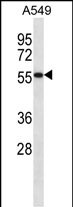 SEMG1 Antibody (N-term) (Cat. #AP14543a) western blot analysis in A549 cell line lysates (35ug/lane).This demonstrates the SEMG1 antibody detected the SEMG1 protein (arrow).