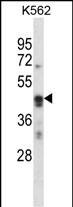 WB - ARC Antibody (N-term) AP14546a