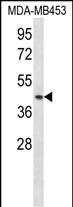 WB - RING1 Antibody (N-term) AP14560A