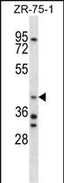 AIP Antibody (C-term) (Cat. #AP14600b) western blot analysis in ZR-75-1 cell line lysates (35ug/lane).This demonstrates the AIP antibody detected the AIP protein (arrow).