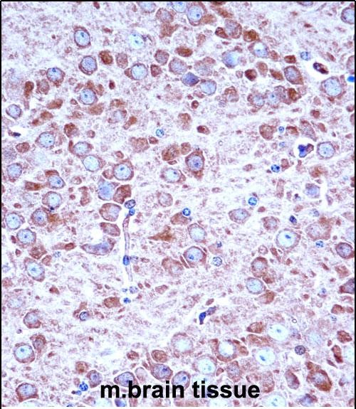 IHC-P - Mouse Aak1 Antibody (Center) AP14604c