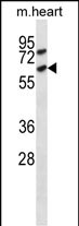 Mouse Acvr1c Antibody (C-term) (Cat. #AP14606b) western blot analysis in mouse heart tissue lysates (35ug/lane).This demonstrates the Acvr1c antibody detected the Acvr1c protein (arrow).