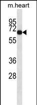 WB - Mouse Adck1 Antibody (C-term) AP14607b
