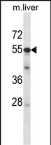 Mouse Adck2 Antibody (Center) (Cat. #AP14608c) western blot analysis in mouse liver tissue lysates (35ug/lane).This demonstrates the Adck2 antibody detected the Adck2 protein (arrow).