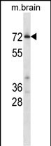 WB - Mouse Cdk17 Antibody (C-term) AP14610B
