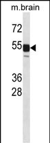 WB - Mouse Clk1 Antibody (N-term) AP14613a