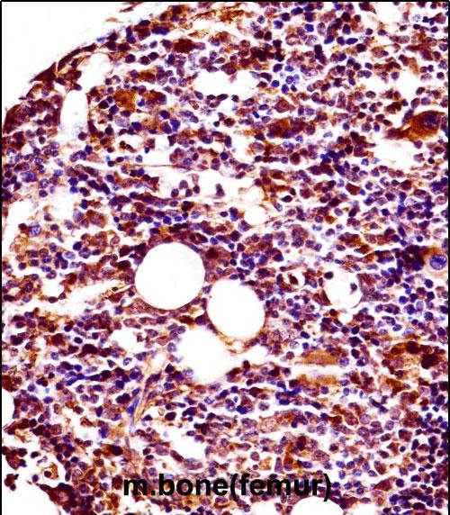 IHC-P - Mouse Lyn Antibody (N-term) AP14624A