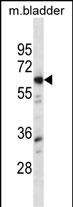 Mouse Lyn Antibody (N-term) (Cat. #AP14624a) western blot analysis in mouse bladder tissue lysates (35ug/lane).This demonstrates the Lyn antibody detected the Lyn protein (arrow).