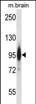 WB - Mouse Prkce Antibody (N-term) AP14630a