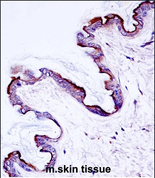 IHC-P - Mouse Prkch Antibody (Center) AP14631C