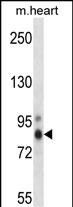 WB - Mouse Prkch Antibody (Center) AP14631C