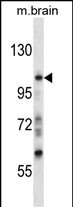 WB - Mouse Sgk223 Antibody (N-term) AP14635a