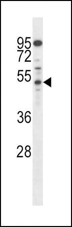AP2M1 Antibody (C-term) (Cat. #AP14642b) western blot analysis in mouse Neuro-2a cell line lysates (35ug/lane).This demonstrates the AP2M1 antibody detected the AP2M1 protein (arrow).