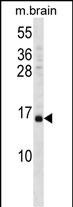 VAMP3 Antibody (Center) (Cat. #AP14660c) western blot analysis in mouse brain tissue lysates (35ug/lane).This demonstrates the VAMP3 antibody detected the VAMP3 protein (arrow).