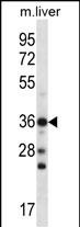 CBX8 Antibody (Center) (Cat. #AP14665c) western blot analysis in mouse liver tissue lysates (35ug/lane).This demonstrates the CBX8 antibody detected the CBX8 protein (arrow).