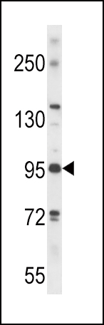 PLD2 Antibody (N-term) (Cat. #AP14669a) western blot analysis in mouse bladder tissue lysates (35ug/lane).This demonstrates the PLD2 antibody detected the PLD2 protein (arrow).
