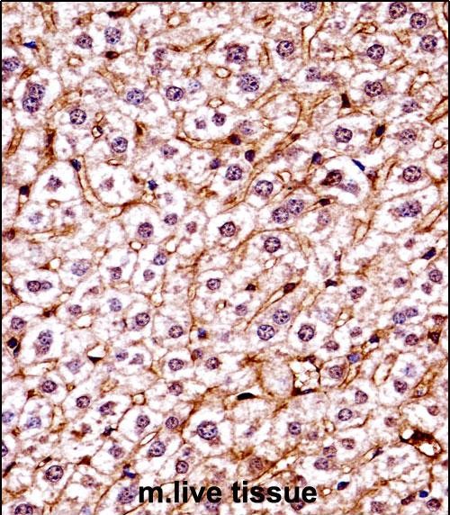 IHC-P - Mouse Csnk1e Antibody (C-term) AP14708b