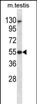 Mouse Dapk3 Antibody (Center) (Cat. #AP14711c) western blot analysis in mouse testis tissue lysates (35ug/lane).This demonstrates the Dapk3 antibody detected the Dapk3 protein (arrow).