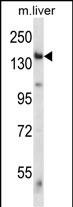 Mouse Eif2ak4 Antibody (C-term) (Cat. #AP14713b) western blot analysis in mouse liver tissue lysates (35ug/lane).This demonstrates the Eif2ak4 antibody detected the Eif2ak4 protein (arrow).
