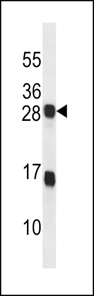 KDELR2 Antibody (C-term) (Cat. #AP14724b) western blot analysis in T47D cell line lysates (35ug/lane).This demonstrates the KDELR2 antibody detected the KDELR2 protein (arrow).