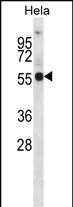 WB - KCNA1 Antibody (Center) AP14746c