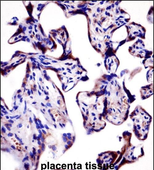 IHC-P - KCNA2 Antibody (C-term) AP14749b