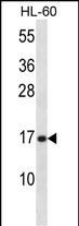 PLA2G5 Antibody (C-term) (Cat. #AP14763b) western blot analysis in HL-60 cell line lysates (35ug/lane).This demonstrates the PLA2G5 antibody detected the PLA2G5 protein (arrow).