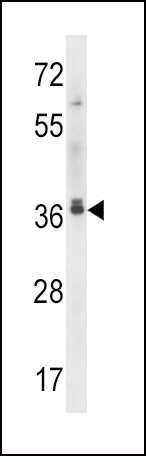 MAPRE2 Antibody (N-term) (Cat. #AP14769a) western blot analysis in CEM cell line lysates (35ug/lane).This demonstrates the MAPRE2 antibody detected the MAPRE2 protein (arrow).