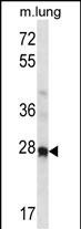 WB - Mouse Hoxa4 Antibody (N-term) AP14774a