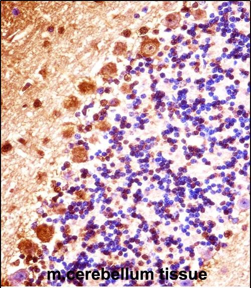 IHC-P - Mouse Stk32b Antibody (C-term) AP14776b