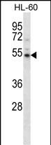 WB - Mouse Camkv Antibody (N-term) AP14781a