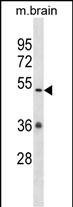 WB - Mouse Camkv Antibody (N-term) AP14781a