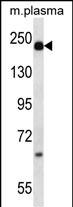 A2M Antibody (N-term) (Cat. #AP14789a) western blot analysis in mouse plasma lysates (35ug/lane).This demonstrates the A2M antibody detected the A2M protein (arrow).