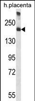 A2M Antibody (C-term) (Cat. #AP14790b) western blot analysis in human placenta tissue lysates (35ug/lane).This demonstrates the A2M antibody detected the A2M protein (arrow).