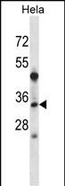 WB - LAT2 Antibody (Center) AP14803c