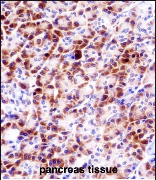 IHC-P - PRSS27 Antibody (C-term) AP14860b