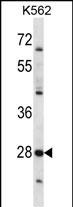WB - PRSS27 Antibody (C-term) AP14860b